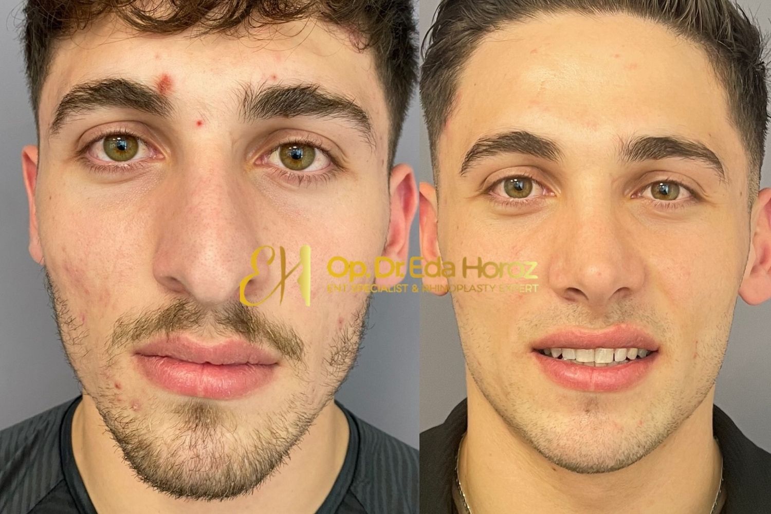 1 (26)