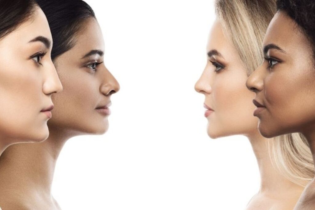 Ethnic Rhinoplasty 3